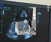 Ultrassom já disponível na rede municipal: mais rapidez, qualidade e comodidade para a população