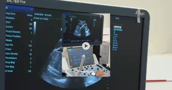 Ultrassom já disponível na rede municipal: mais rapidez, qualidade e comodidade para a população